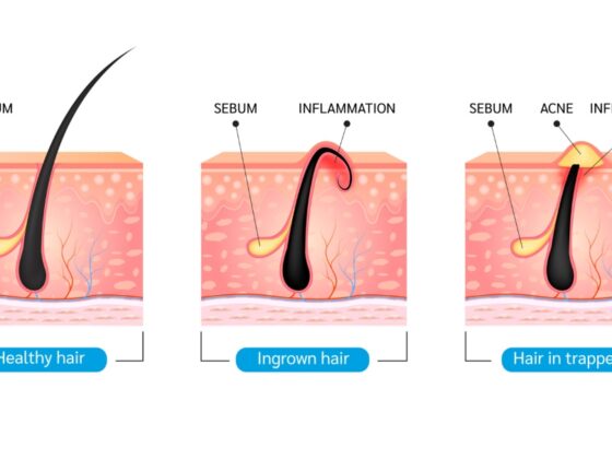 infographics of hair and skin