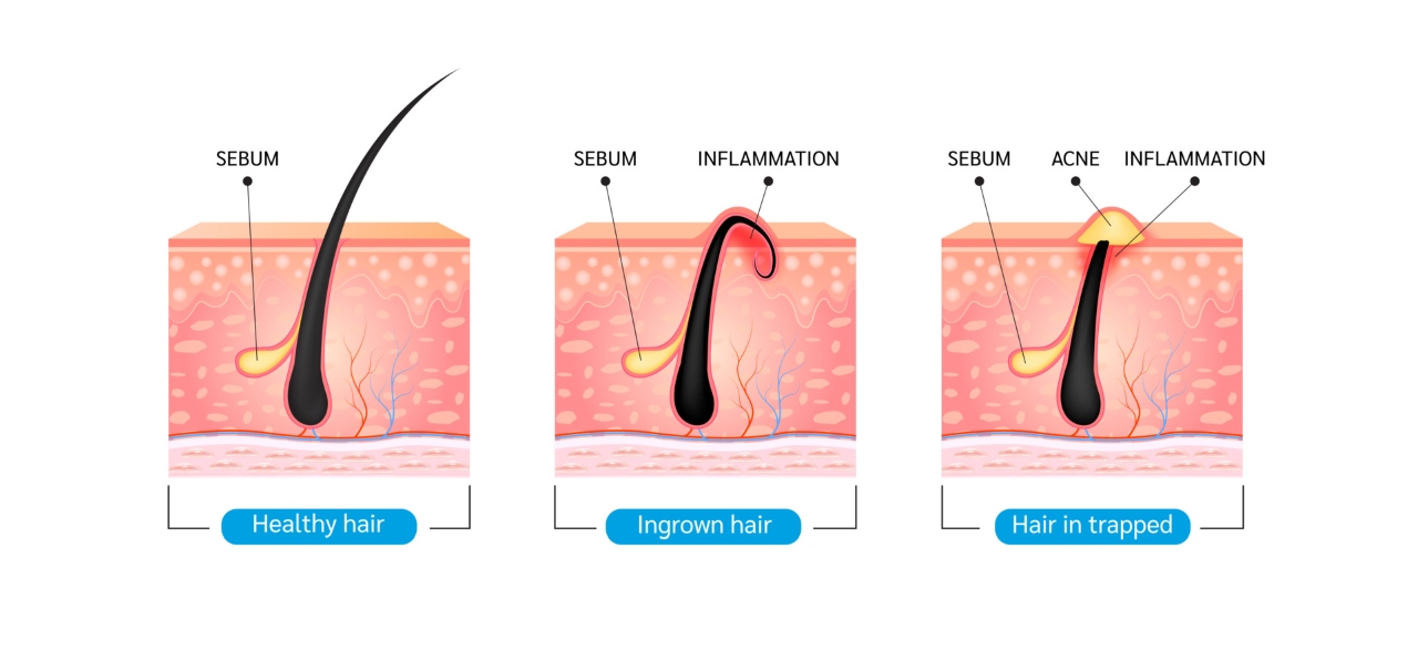 infographics of hair and skin